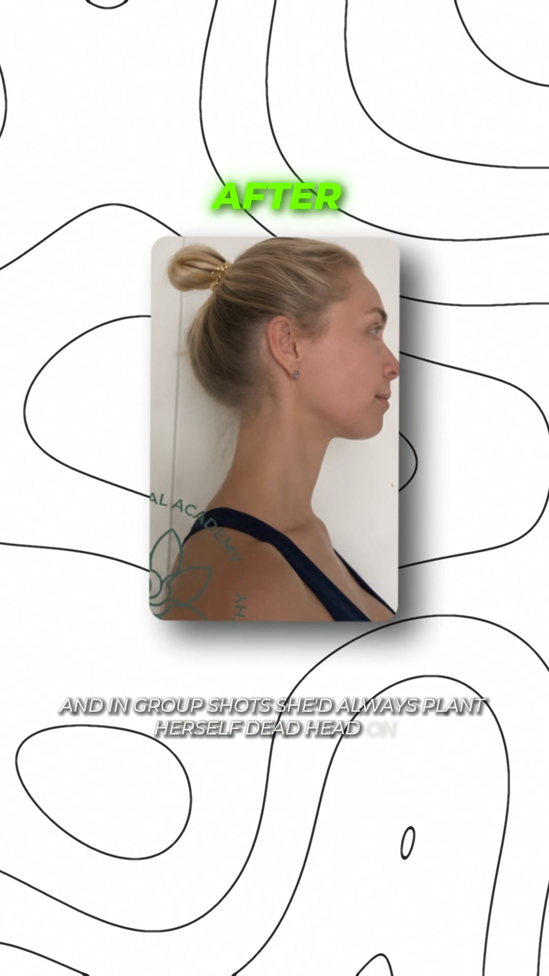 Maxilla Program by Dr. Ales Ulishchenko ad creative, July 2026